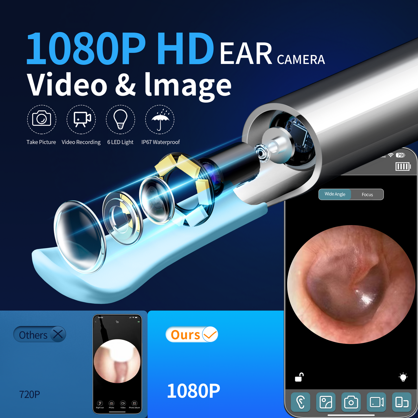 KEKOY 1080P Ear Wax Removal Kit